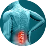 An illustrated view of a human figure with a transparent overlay of the spine highlights the lower back area in red, indicating pain or inflammation. This visual effectively represents conditions such as lumbar strain, sciatica, or spinal issues—ideal for pages related to chiropractic care, physical therapy, or pain management services on the Indiantrail website.