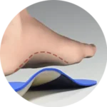 Custom Orthotics Service Near Me in Indian Trail, NC. Chiropractor For Orthotics.