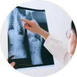 Scoliosis Treatment Near Me Indian Trail, NC. Chiropractor For Scoliosis.