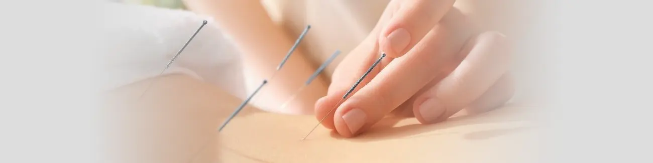 Acupuncture Treatment Near Me in Indian Trail, NC. Chiropractor For Acupuncture Therapy.