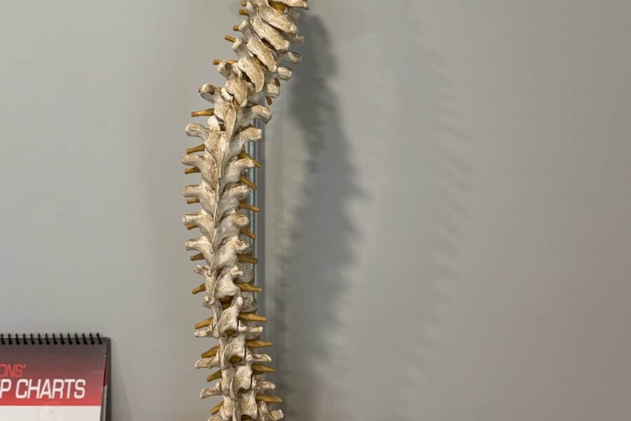 Full spine model hanging on the wall with pelvis attached in a chiropractic treatment room.