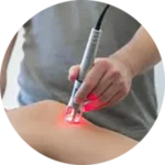 Laser Therapy Treatment Near Me in Indian Trail, NC. Chiropractor For Laser Therapy Treatments.