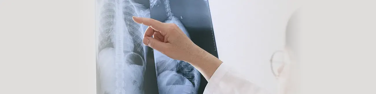 Scoliosis Treatment Near Me in Indian Trail, NC. Chiropractor For Scoliosis Pain Relief.